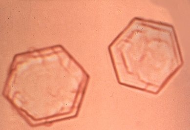 Epithelial Cells (Hexagons) of the eye 